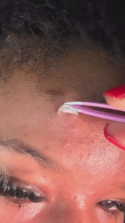 Marlynnae Glow - HydroHugs Pimple Patches